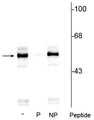 Western blot of rat brainstem lysate showing specific immunolabeling of the ~55 kDa TPH protein phosphorylated at Ser260 in lane one (-). Phosphospecificity is shown in the second lane (P) where immunolabeling is blocked by preadsorption with the phosphopeptide used as antigen, but not by the corresponding non-phosphopeptide (NP), shown in the third lane.