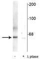 Western blot of rat synaptic membrane showing specific immunolabeling of the ~66 kDa PLK protein phosphorylated at Thr210 in the first lane (-). Phosphospecificity is shown in the second lane (+) where the immunolabeling is completely eliminated by blot treatment with lambda phosphatase (λ-Ptase, 1200 units for 30 minutes).