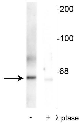 Western blot of rat synaptic membrane showing specific immunolabeling of the ~66 kDa PLK protein phosphorylated at Thr210 in the first lane (-). Phosphospecificity is shown in the second lane (+) where the immunolabeling is completely eliminated by blot treatment with lambda phosphatase (λ-Ptase, 1200 units for 30 minutes).