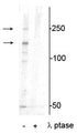 Western blot of mouse heart lysate showing specific immunolabeling of the ~250 kDa and ~150 kDa splice variants of the XIRP1 protein phosphorylated at Ser295 in the first lane (-). Phosphospecificity is shown in the second lane (+) where the immunolabeling is completely eliminated by blot treatment with lambda phosphatase (λ-Ptase, 1200 units for 30 minutes).