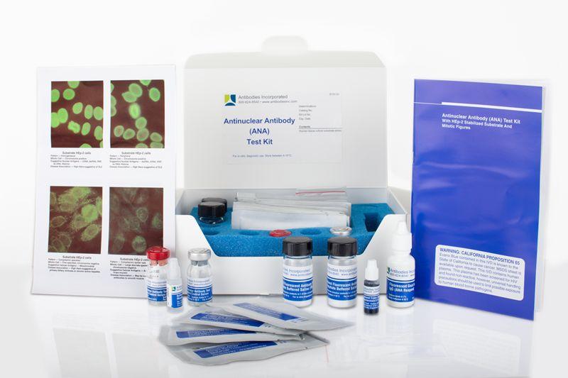 ANA Kit (10 x 12-well slides)