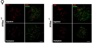 Double immunofluorescence of ACA and SYCP3 in 16.5 dpc mouse oocytes. Image from publication CC-BY-4.0. PMID:36429134