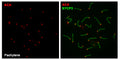 Immunolabeling of spreaded WT mouse pachytene spermatocytes positively labeling CREST/Centromere Protein (red,  Cat 15-235, 1:20) and SYCP3 (green). Image kindly provided by Fernando Sánchez Sáez and Alberto M. Penás from Universidad de Salamanca, Spain.