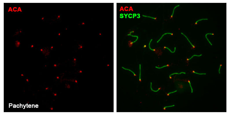 Immunolabeling of spreaded WT mouse pachytene spermatocytes positively labeling CREST/Centromere Protein (red, Cat 15-235, 1:20) and SYCP3 (green). Image kindly provided by Fernando Sánchez Sáez and Alberto M. Penás from Universidad de Salamanca, Spain.