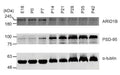 Expression levels of ARID1B protein in WT mouse brains at E18, P0, P7, P14, P21, P28, P35, and P42, as determined by immunoblot analysis of whole-brain lysates. PSD-95, an abundant excitatory postsynaptic density protein, is shown for comparison. The full-length blot was divided into three parts for immunoblotting with different antibodies. Similar results were obtained from three independent experiments. Image from publication CC-BY-4.0. PMID: 36030255