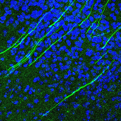 Immunostaining of mouse brain cortex identifying the calcium channels along axons stained with Anti-Cav1.3 Ca2+ Channel Antibody (Cat. 75-080, 1:500, green) and nuclei are labeled with DAPI (blue). Image kindly provided by Kaveh Moradi, Virginia Commonwealth University.