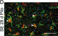 Immunostaining of mouse hippocampal CA1 region showing GFAP and IL1B labeling of astrocytes 28 days after pilocarpine induced status epilepticus (SE). DAPI for nucleic acid counterstain (blue). Image from publication CC-BY-4.0. PMID: 35972937