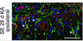 Immunostaining of mouse hippocampal CA1 region showing GFAP and IL1B labeling of astrocytes 28 days after KA-induced status epilepticus (SE). DAPI for nucleic acid counterstain (blue). Image from publication CC-BY-4.0. PMID: 35972937