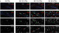 Immunostaining of mouse hippocampal CA1 region showing Aif1; green (microglia) and Gfap; red (astrocytes) staining 72 hrs, 10 days and 28 days after pilocarpine-induced status epilepticus (SE), SE (SE Pilo), compared to non-SE control animals (Ctr Pilo). DAPI for nucleic acid counterstain (blue). Image from publication CC-BY-4.0. PMID: 35972937