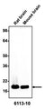 Western blotting of rat or mouse brain homogenate (10 µg/lane) with Antibodies Incorporated anti-alpha-synuclein antibodies at 1:200 dilution and detected with anti-mouse HRP.