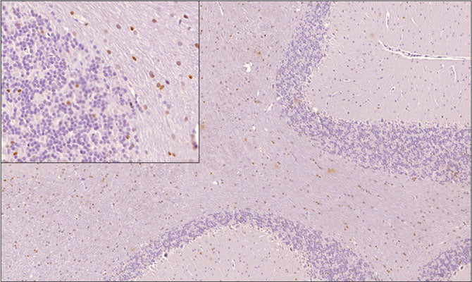 Sagittal section of formalin fixed, paraffin-embedded rat brain showing nuclear staining of OLIG2 positive cells within the white matter of cerebellum as expected. Inset (top left) shows higher magnification. Sections were stained with AvesLabs chicken anti-OLIG2 antibody at 1:1,000 dilution and detected with anti-chicken HRP. 