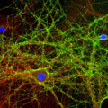 Mixed neuron-glial cultures stained with CPCA-GAP43 (green) and rabbit antibody to alpha-II spectrin (RPCA-aII-Spec, red), and DNA (blue). The GAP43 antibody stains numerous axonal and dendritic profiles in these cultures, clearly revealing the submembraneous cytoskeleton and vesicles. Photo by Dr. Gerry Shaw, Univ. Florida.