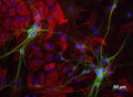 Neonatal mouse brain cortical cultures were stained with Aves Labs MAP2 (green) and GFAP (red, rabbit antibody); Blue is DAPI nuclear stain. Photo courtesy of Dr. Gerry Shaw, Univ. Florida.