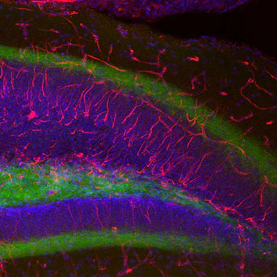 Anti-Nestin Antibody | NES