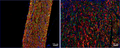 Immunofluorescence of a section of injured (right, crushed) and normal (left) mouse sciatic nerve labeled with Anti-P-Zero Myelin Protein (1:1000, red), colabeled with Anti-Neurofilament NF-L (green), and DAPI labeling nuclei. Scale bar, 50 μm; Magnification, 20×. Image kindly provided by Prem Kumar, Department of Orthopedics and Rehabilitation, Penn State University College of Medicine, John C. Elfar lab.