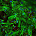 Immunostaining of paraformaldehyde-fixed (4%) cultures of SpH64 neuroblastoma cells showing β-Tubulin 3 immunostaining (green, 1:1000). Red staining is rabbit-anti-actin (1:1000); blue is DAPI nuclear counterstain. Secondary antibodies were fluorescein-labeled goat anti-chicken IgY (Cat. F-1005, 1:1000); Texas Red-labeled goat anti-rabbit IgG. Page Balisch (University of Arizona).