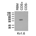 Immunoblot on adult rat brain membrane (RBM) and lysates from Kv1.6-transfected (COS+) and untransfected (COS-) COS cells.
