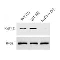 Immunoblot of crude membrane fractions from adult heart ventricle (V) and brain (B) from wild-type (WT) and Kvß1 knockout (Kvβ1) mice probed with K47/42 (Kvβ1.2, top) and K17/70 (Kvβ2, bottom). Data courtesy of Jeanne Nerbonne, Washington University SOM. Reproduced with permission from 2005 Aimond et al. Circ Res.
