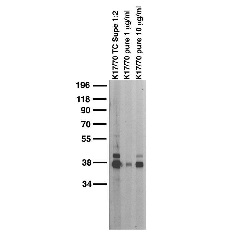 Adult rat brain membrane immunoblot.