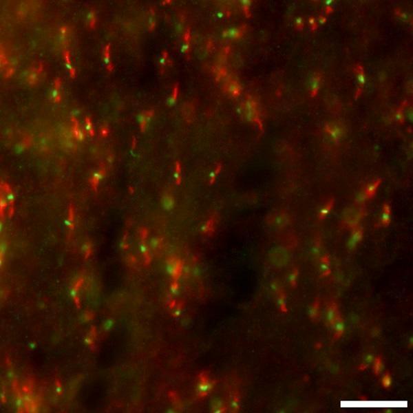 Immunofluorescence staining of adult rat optic nerve with K73/20 (red) and βIV-spectrin rabbit polyclonal (green). Image courtesy of Matt Rasband (Baylor College of Medicine).
