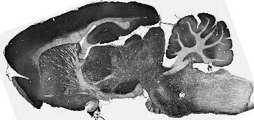 Adult rat brain immunohistochemistry.