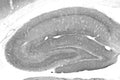 Adult rat hippocampus immunohistochemistry.