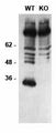 Immunoblot versus whole cell extracts from embryonic day 15 telencephalon from DLX1/2 wild-type (WT) and knockout (KO) mice. Data courtesy of Dr. Mario Hernan and Dr. John Rubenstein, UCSF.