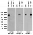 Adult rat brain membrane (RBM) and transfected cell immunoblot: extracts of RBM and COS cells transiently transfected with Myc-tagged NGL-1, NGL-2, NGL-3 or untagged Kv2.1 plasmid and probed with N49A/21 (left and middle) or K89/34 (right) TC supe.