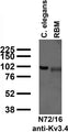 Immunoblot against crude C. elegans worm extracts and brain membranes from adult rat (RBM) probed with N72/16 TC supe.