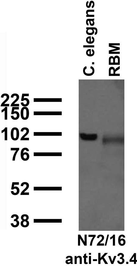 Immunoblot against crude C. elegans worm extracts and brain membranes from adult rat (RBM) probed with N72/16 TC supe.