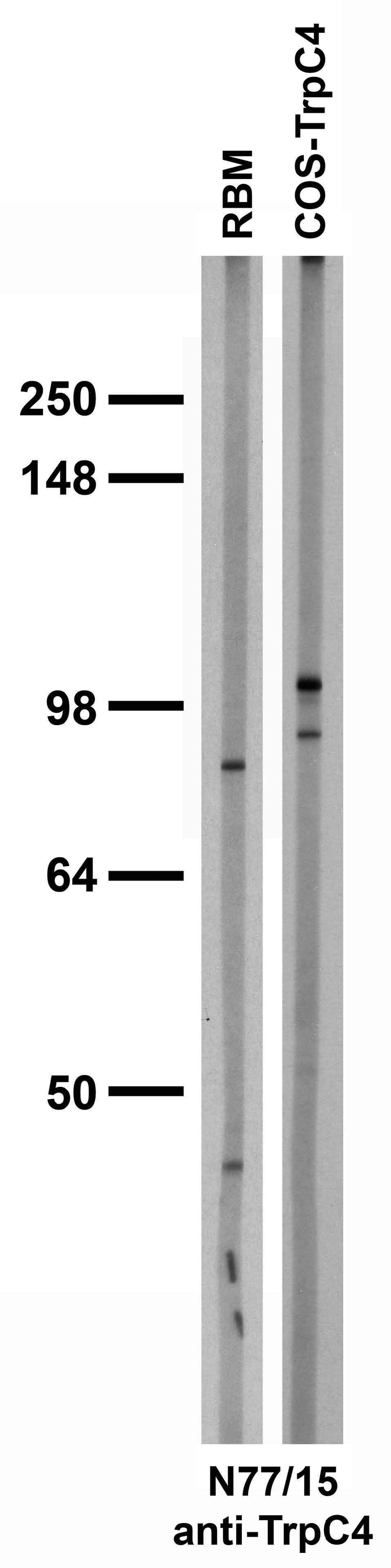 Adult rat brain membrane (RBM) and transfected cell immunoblot: extracts of RBM and COS cells transiently transfected with TrpC4 and probed with N77/15 TC supe.