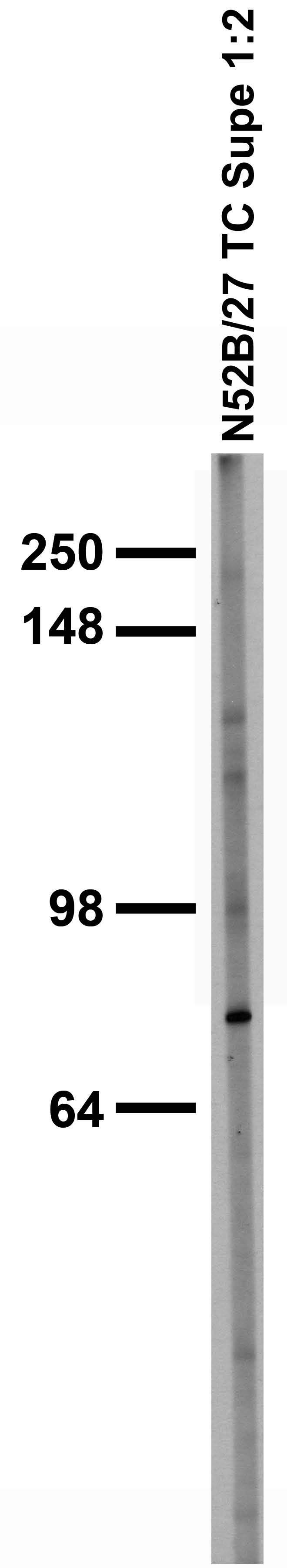 Adult rat brain membrane immunoblot.