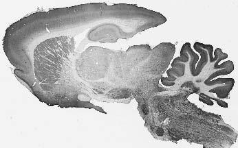 Adult rat brain immunohistochemistry.