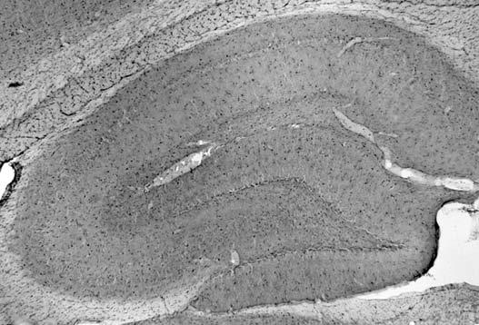 Adult rat hippocampus immunohistochemistry.