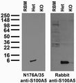 Immunoblot versus adult rat brain membranes (RBM) and whole brain homogenates from S100A5-tauGFP (targeted deletion of S100A5 and replaced with coding region of tau fused to GFP) heterozygote (Het) and KO mice and probed with N176A/35 TC supe (left) and rabbit anti-S100A5 antibody (right). Samples courtesy of Tim McClintock, University of Kentucky.