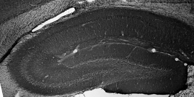 Adult rat hippocampus immunohistochemistry.