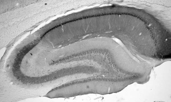 Adult rat hippocampus immunohistochemistry.