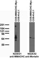 Transfected cell immunoblot: extracts of COS cells transiently transfected with Myc-tagged MMACHC or untagged Kv2.1 plasmid and probed with N230/21 (left) and N52A/42 (right) TC supe.