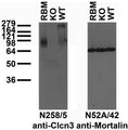 Immunoblot versus crude membranes from adult rat brain (RBM) and WT and Clcn3 KO mouse brains probed with N258/5 (left) and N52A/42 (right) TC supe. Mouse brains courtesy of Fred Lamb (University of Iowa.