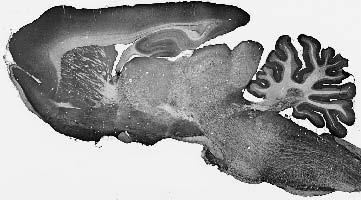 Anti-BBS3/Arl6 Antibody (N302/10) 75-270