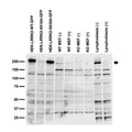 "Endogenous and transfected cell immunoblot: extracts of HEK-293 cells transfected with GFP-tagged LRRK2-WT, LRRK2-S910A or LRRK2-S935A plasmid; fibroblasts from embryonic WT or LRRK2 KO mice untreated or treated with LRRK2-IN-1 inhibitor (2011 Deng et al Nat Chem Biol); and human lymphoblasts untreated or treated with LRRK2-IN-1, probed with 1D8. Data courtesy of Nicolas Dzamko, Paul Davies and Dario Alessi (University of Dundee, Scotland, UK)."
