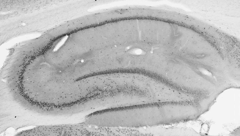 Adult rat hippocampus immunohistochemistry.