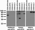 Transfected cell immunoblot: extracts of COS cells transiently transfected with HA-tagged ATF4 or untagged ATF5 or Kv2.1 plasmid and probed with N360A/24 TC supe (left), Rabbit anti-ATF5 (middle) or K89/34 TC supe (right).