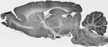 Adult rat brain immunohistochemistry.