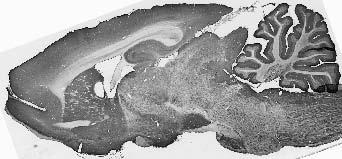 Adult rat brain immunohistochemistry.