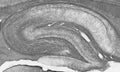 Adult rat hippocampus immunohistochemistry.