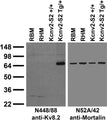 Immunoblot against membrane fractions from adult rat brain (RBM) and heart (RHM) and Kcnv2-S2 mouse wild-type (+/+) and higher-expressing transgenic (Tg/+) brains probed with N448/88 (left) and N52A/42 (right) TC supe. Mouse brain samples courtesy of Jennifer Kearney (Northwestern).