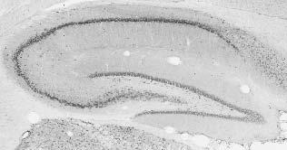 Adult rat hippocampus immunohistochemistry.
