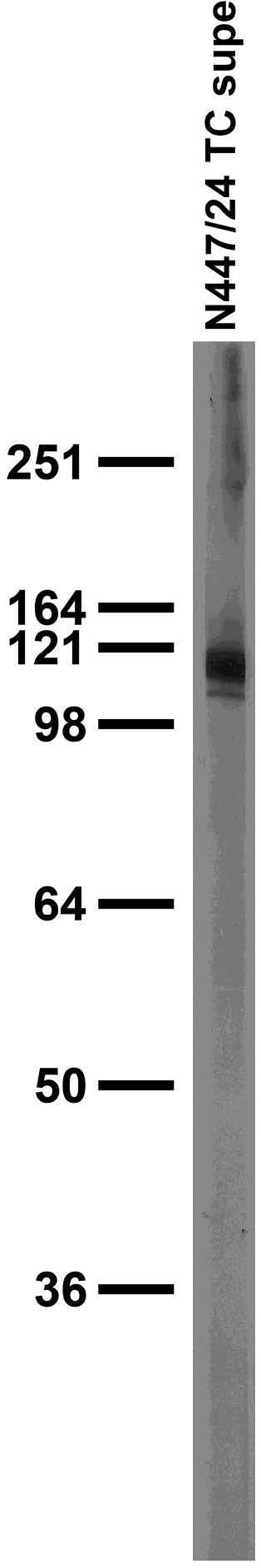 Adult rat brain membrane immunoblot.