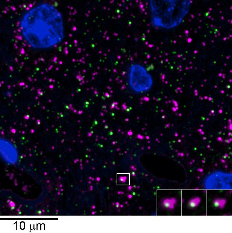 Array tomography immunofluorescence of an LRWhite-embedded 70 nm section from adult mouse cortex with L106/83 (green), rabbit mAb GAD2 (Cell Signaling 5843, magenta) and DAPI (blue). The insert shows three consecutive sections through the synapse that is marked with a white box. Image courtesy of Kristina Micheva (Stanford).
